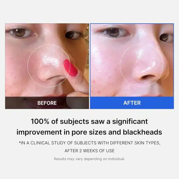 MedicubeZEROPOREPAD2.070pcsmakeupchari