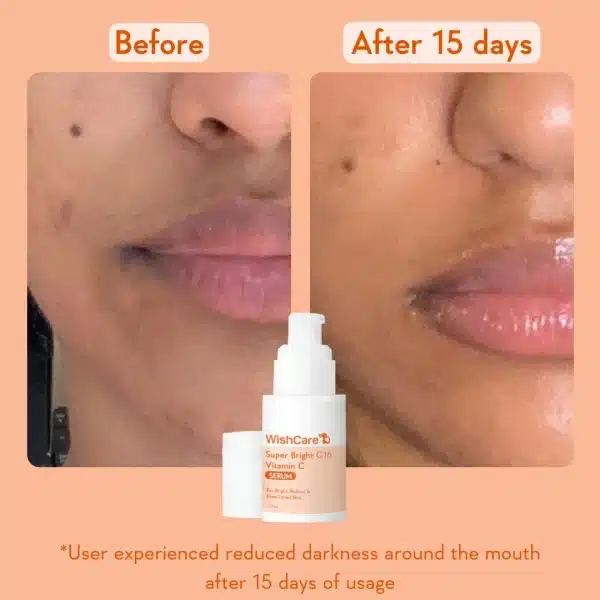 WishCare Super Bright Vitamin C16 Serum 30ml