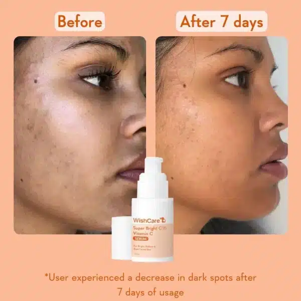 WishCare Super Bright Vitamin C16 Serum 30ml